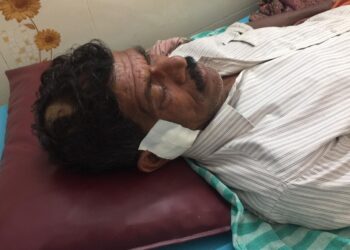 ಅನಂತಾಡಿ: ದನ ಮೇಯಲು ಹೋದ ವಿಷಯವಾಗಿ ತಮ್ಮ ನಿಂದ ಅಣ್ಣನ ಮೇಲೆ ಮಾರಾಣಾಂತಿಕ ಹಲ್ಲೆ:; ಆಸ್ಪತ್ರೆಗೆ ದಾಖಲು