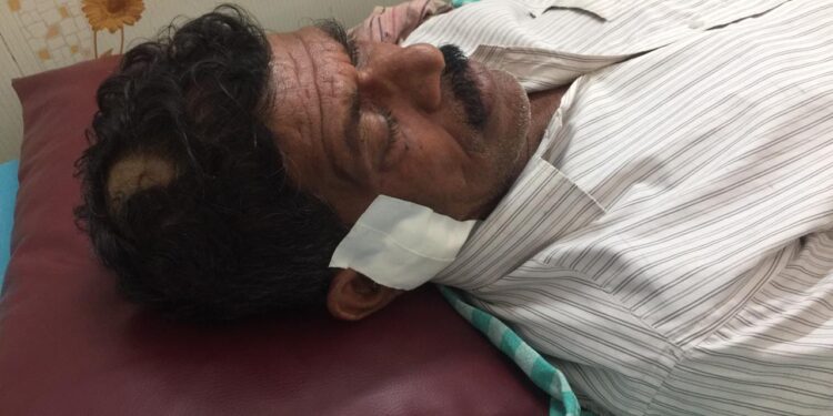 ಅನಂತಾಡಿ: ದನ ಮೇಯಲು ಹೋದ ವಿಷಯವಾಗಿ ತಮ್ಮ ನಿಂದ ಅಣ್ಣನ ಮೇಲೆ ಮಾರಾಣಾಂತಿಕ ಹಲ್ಲೆ:; ಆಸ್ಪತ್ರೆಗೆ ದಾಖಲು