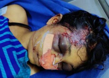 ಮೂಡಬಿದ್ರೆ: ಪತಿಯಿಂದಲೇ ಪತ್ನಿಯ ಬರ್ಬರ ಕೊಲೆ:; ಆರೋಪಿ ದಿನ್ ರಾಜ್ ನ ಬಂಧನ