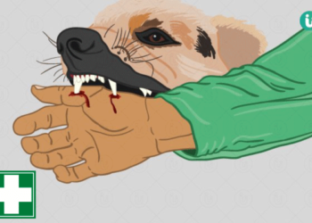 ಬಡಗನ್ನೂರು : ಕುದ್ದುಪದವು ಮೂಲದ 12 ವರ್ಷದ ಬಾಲಕನಿಗೆ ನಾಯಿ ಕಚ್ಚಿ ಗಂಭೀರ : ಮಂಗಳೂರು ಆಸ್ಪತ್ರೆಗೆ ರವಾನೆ