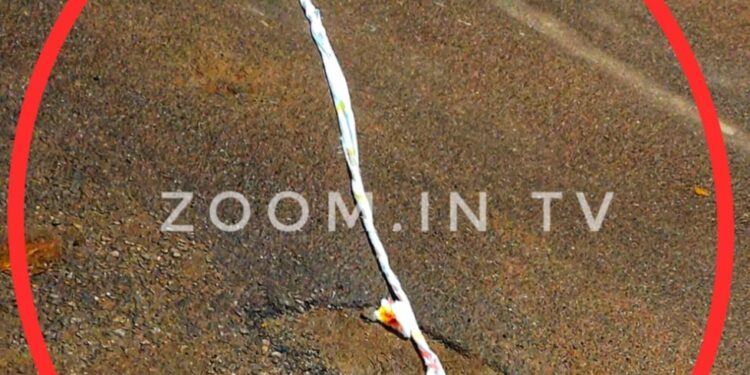 ದರ್ಬೆ: ಪಾದಚಾರಿಗೆ ಲಾರಿ ಡಿಕ್ಕಿ: ಆಸ್ಪತ್ರೆಗೆ ದಾಖಲು: ಚಿಕಿತ್ಸೆ ಪಡೆದು ಬ್ಯಾಂಡೇಜ್ ಕಿತ್ತೆಸೆದು  ಗಾಯಾಳು ಎಸ್ಕೇಪ್.!!!