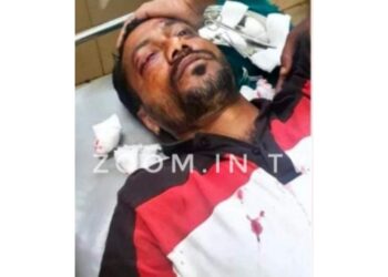 ತುಮಕೂರು: ಬಜರಂಗದಳ ಜಿಲ್ಲಾ ಸಂಚಾಲಕ ಮಂಜು ಭಾರ್ಗವ್ ಮೇಲೆ ದುಷ್ಕರ್ಮಿಗಳಿಂದ ಮಾರಣಾಂತಿಕಹಲ್ಲೆ:; ಇಂದು ಸ್ವಯಂ ಪ್ರೇರಿತ ಬಂದ್ ಗೆ ಹಿಂದೂ ಸಂಘಟನೆಗಳಿಂದ ಕರೆ