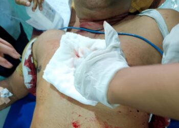 ಮಂಗಳೂರು: ವೈಯಕ್ತಿಕ ದ್ವೇಷ ಹಿನ್ನೆಲೆ ವ್ಯಕ್ತಿಯೋರ್ವರಿಗೆ ಚೂರಿ ಇರಿತ..!!