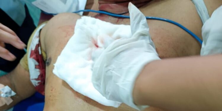 ಮಂಗಳೂರು: ವೈಯಕ್ತಿಕ ದ್ವೇಷ ಹಿನ್ನೆಲೆ ವ್ಯಕ್ತಿಯೋರ್ವರಿಗೆ ಚೂರಿ ಇರಿತ..!!