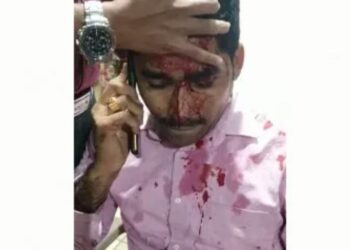 ಮಂಗಳೂರು: ಖಾಸಗಿ ನ್ಯೂಸ್‌ ಚಾನೆಲ್‌ನ ಜಿಲ್ಲಾ ವರದಿಗಾರನ ಮೇಲೆ ಮಾರಣಾಂತಿಕ ಹಲ್ಲೆ..!! ಆರೋಪಿಯ ಬಂಧನ