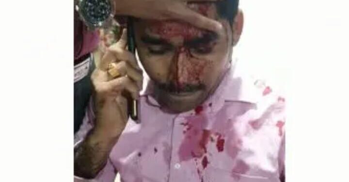 ಮಂಗಳೂರು: ಖಾಸಗಿ ನ್ಯೂಸ್‌ ಚಾನೆಲ್‌ನ ಜಿಲ್ಲಾ ವರದಿಗಾರನ ಮೇಲೆ ಮಾರಣಾಂತಿಕ ಹಲ್ಲೆ..!! ಆರೋಪಿಯ ಬಂಧನ