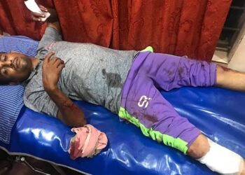 ಮಂಗಳೂರು: ಮಾರಕಾಸ್ತ್ರಗಳಿಂದ ಎಸ್.ಡಿ.ಪಿ.ಐ. ಕಾರ್ಯಕರ್ತನ ಮೇಲೆ ಹಲ್ಲೆ..!! ಆಸ್ಪತ್ರೆಗೆ ದಾಖಲು