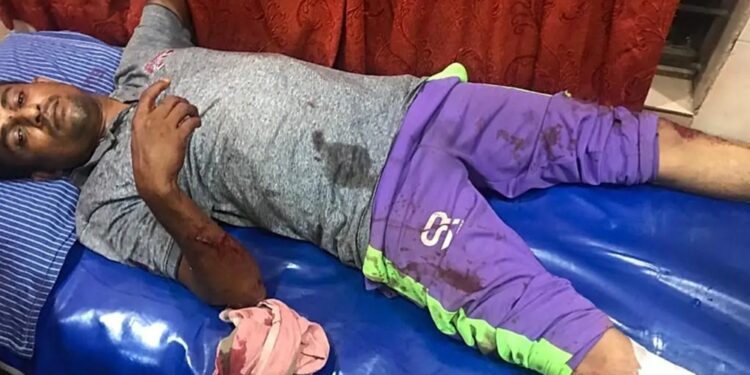 ಮಂಗಳೂರು: ಮಾರಕಾಸ್ತ್ರಗಳಿಂದ ಎಸ್.ಡಿ.ಪಿ.ಐ. ಕಾರ್ಯಕರ್ತನ ಮೇಲೆ ಹಲ್ಲೆ..!! ಆಸ್ಪತ್ರೆಗೆ ದಾಖಲು