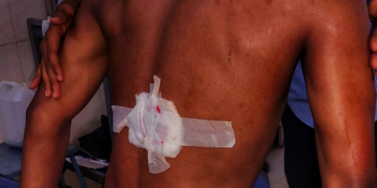 ಪುತ್ತೂರು: ಪ್ರತಿಭಟನೆ ಮುಗಿದ ಬೆನ್ನಲ್ಲೆ ಮತ್ತೆ ಹೊಡೆದಾಡಿಕೊಂಡ ವಿದ್ಯಾರ್ಥಿಗಳು..!! ಮೂವರು ವಿದ್ಯಾರ್ಥಿಗಳಿಗೆ ಗಾಯ