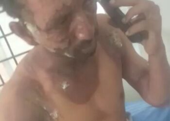 ಅರಂತೋಡು: ಅಯ್ಯಂಗಾರ್ ಬೇಕರಿಯಲ್ಲಿ ಅಡುಗೆ ಗ್ಯಾಸ್ ತಾಗಿ ವ್ಯಕ್ತಿಗೆ ಗಾಯ: ಆಸ್ಪತ್ರೆಗೆ ದಾಖಲು