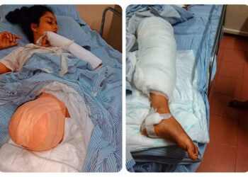 ಬೆಳೆಯುವ ಸಿರಿ ಬಾಡದಿರಲಿ.. ಅನುಕಂಪದ ಅಲೆ ಪಸರಿಸಲಿ..ಈ ಹೆಣ್ಮಗಳ ಜೀವನದಲ್ಲಿ ಭಾಗ್ಯಲಕ್ಷ್ಮಿ ಯನ್ನು ತರುವ ಪುಣ್ಯದ ಕಾರ್ಯ ಮಾಡೋಣವೇ..!?