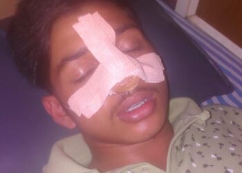 ವಿಟ್ಲ: ಕ್ರಿಕೆಟ್ ಆಟದ ವಿಚಾರವಾಗಿ ಅಪ್ರಾಪ್ತ ಬಾಲಕನ ಮೇಲೆ ಮಾರಣಾಂತಿಕ ಹಲ್ಲೆ: ಪ್ರಕರಣ ದಾಖಲು..!!