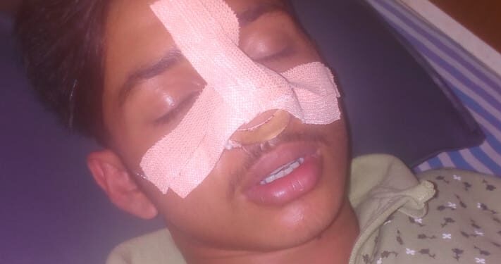 ವಿಟ್ಲ: ಕ್ರಿಕೆಟ್ ಆಟದ ವಿಚಾರವಾಗಿ ಅಪ್ರಾಪ್ತ ಬಾಲಕನ ಮೇಲೆ ಮಾರಣಾಂತಿಕ ಹಲ್ಲೆ: ಪ್ರಕರಣ ದಾಖಲು..!!