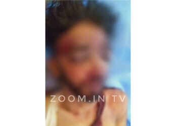 ಬೆಂಗಳೂರಿನಲ್ಲಿ ದ್ವಿಚಕ್ರ ವಾಹನ ಅಪಘಾತ: ಪುತ್ತೂರಿನ ಯುವಕನಿಗೆ ಗಾಯ: ಆಸ್ಪತ್ರೆಗೆ ದಾಖಲು..!!