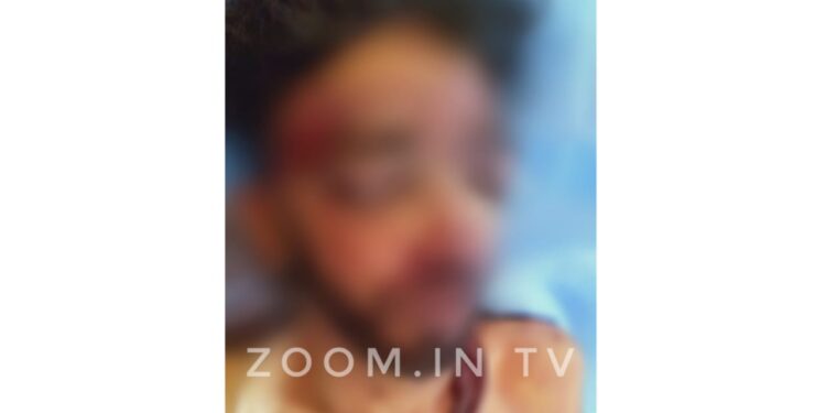 ಬೆಂಗಳೂರಿನಲ್ಲಿ ದ್ವಿಚಕ್ರ ವಾಹನ ಅಪಘಾತ: ಪುತ್ತೂರಿನ ಯುವಕನಿಗೆ ಗಾಯ: ಆಸ್ಪತ್ರೆಗೆ ದಾಖಲು..!!