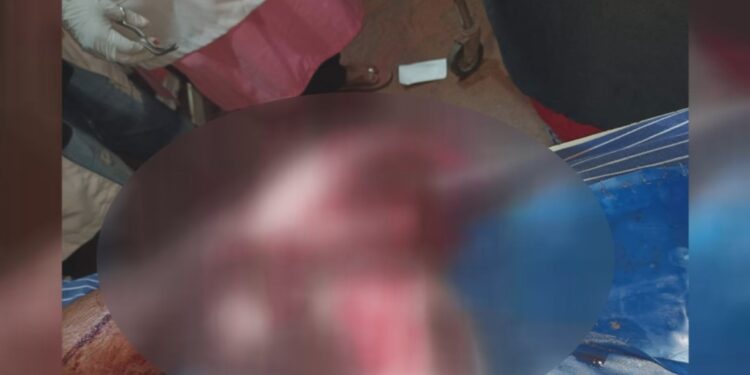 ಉಳ್ಳಾಲ: ಟೆಂಪೋ ಅಡ್ಡಗಟ್ಟಿ ಮೀನಿನ ವ್ಯಾಪಾರಿಗೆ ತಲವಾರಿನಿಂದ ಹಲ್ಲೆ..!!