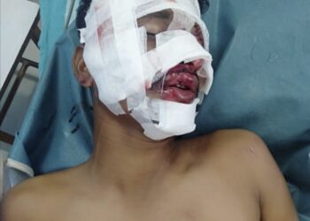 ಮಾಣಿ: ರಿಕ್ಷಾ ಪಲ್ಟಿಯಾಗಿ ಗಂಭೀರ ಸ್ಥಿತಿಯಲ್ಲಿದ್ದ ವ್ಯಕ್ತಿಯನ್ನು ಕೂಡಲೇ ಆಸ್ಪತ್ರೆಗೆ ಸೇರಿಸಿ ಮಾನವೀಯತೆ ಮೆರೆದ ವಿಕೇಶ್ ಶೆಟ್ಟಿ