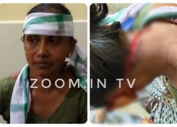 ವಿಟ್ಲ: ಮಹಿಳೆ ಮೇಲೆ ವ್ಯಕ್ತಿಯೋರ್ವನಿಂದ ಮಾರಣಾಂತಿಕ ಹಲ್ಲೆ: ಪುತ್ತೂರು ಆಸ್ಪತ್ರೆಗೆ ದಾಖಲು..!!