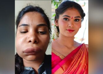 ಸ್ಯಾಂಡಲ್​ವುಡ್ ನಟಿ ಪಾಲಿಗೆ ವಿಲನ್ ಆದ ವೈದ್ಯೆ: ಹಾಳಾಗೋಯ್ತು ಗೊಂಬೆಯಂತಿದ್ದ ಮುಖ..!!