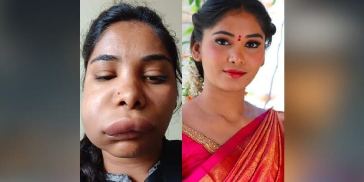 ಸ್ಯಾಂಡಲ್ವುಡ್ ನಟಿ ಪಾಲಿಗೆ ವಿಲನ್ ಆದ ವೈದ್ಯೆ: ಹಾಳಾಗೋಯ್ತು ಗೊಂಬೆಯಂತಿದ್ದ ಮುಖ..!!