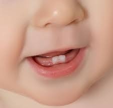 ಹುಟ್ಟುವಾಗಲೇ ನವಜಾತ ಶಿಶುವಿನ ಬಾಯಲ್ಲಿ ಹಲ್ಲು: ಮಂಜೇಶ್ವರದಲ್ಲೊಂದು ಅಪರೂಪದ ಘಟನೆ