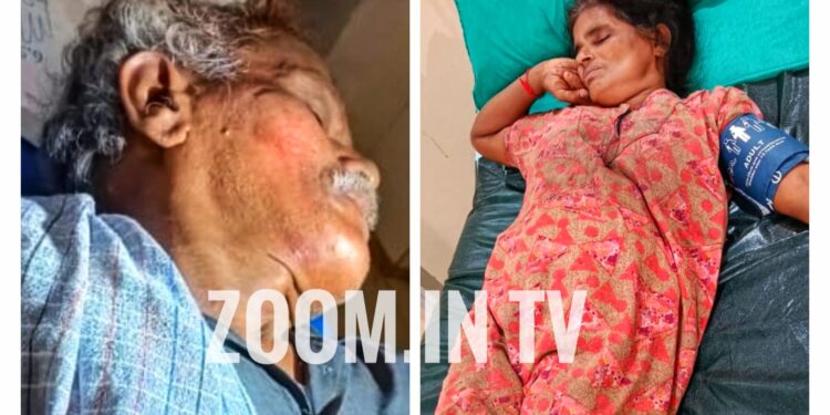 ವಿಟ್ಲ: ಜಾಗದ ವಿಚಾರವಾಗಿ ತಕರಾರು: ಮನೆಗೆ ನುಗ್ಗಿ ಮಹಿಳೆಗೆ ಹಲ್ಲೆ, ತಡೆಯಲು ಬಂದ ಗಂಡನ ಮೇಲೂ ಹಲ್ಲೆ ಆರೋಪ:; ದಂಪತಿಗಳಿಬ್ಬರು ಆಸ್ಪತ್ರೆಗೆ ದಾಖಲು..!!