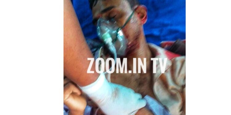 ವಿಟ್ಲ: ಓವರ್ ಟೇಕ್ ಮಾಡುವ ವೇಳೆ ಜೀಪ್ ಗೆ ಡಿಕ್ಕಿ ಹೊಡೆದ ಆಕ್ಟಿವಾ: ದ್ವಿಚಕ್ರ ವಾಹನ ಸವಾರನಿಗೆ ಗಾಯ: ಆಸ್ಪತ್ರೆಗೆ ದಾಖಲು