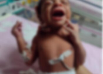 ತೊಕ್ಕೊಟ್ಟು: ರಸ್ತೆ ಬದಿ ನಿಲ್ಲಿಸಿದ್ದ ಕಾರಿನಡಿ ನವಜಾತ ಶಿಶು ಪತ್ತೆ..!!