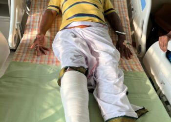 ನಟ ಅರವಿಂದ್ ಬೋಳಾರ್ ಗೆ ಅಪಘಾತ : ಆಸ್ಪತ್ರೆಗೆ ದಾಖಲು