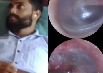 ಕಾರ್ಯಕರ್ತರ ಮೇಲೆ ಪೊಲೀಸ್ ದೌರ್ಜನ್ಯ : ಗಂಭೀರ ಗಾಯಗೊಂಡ ಕಾರ್ಯಕರ್ತನ ಹರಿದ ಕಿವಿಯ ತಮಟೆ : ವೈದ್ಯಕೀಯ ವರದಿ ಹೊರಬೀಳುತ್ತಿದ್ದಂತೆ ಎಸ್.ಪಿ ಯನ್ನು ಭೇಟಿಯಾದ ಪುತ್ತಿಲ
