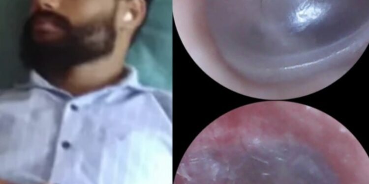 ಕಾರ್ಯಕರ್ತರ ಮೇಲೆ ಪೊಲೀಸ್ ದೌರ್ಜನ್ಯ : ಗಂಭೀರ ಗಾಯಗೊಂಡ ಕಾರ್ಯಕರ್ತನ ಹರಿದ ಕಿವಿಯ ತಮಟೆ : ವೈದ್ಯಕೀಯ ವರದಿ ಹೊರಬೀಳುತ್ತಿದ್ದಂತೆ ಎಸ್.ಪಿ ಯನ್ನು ಭೇಟಿಯಾದ ಪುತ್ತಿಲ