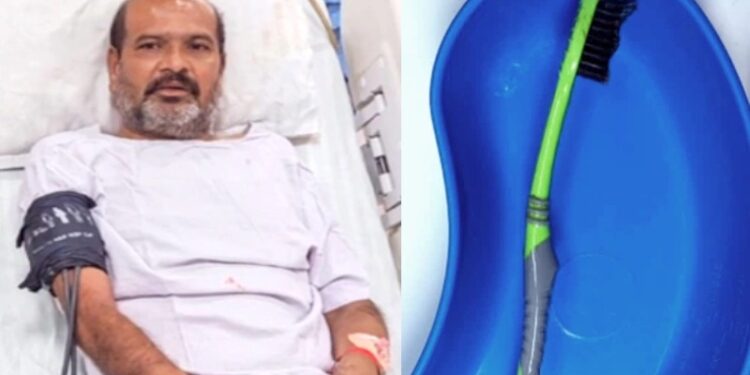 ಹಲ್ಲುಜ್ಜುವಾಗ ಟೂತ್ ಬ್ರಷ್ ನುಂಗಿದ ಆಸಾಮಿ : 12 ಸೆಂ.ಮೀ. ಉದ್ದದ ಬ್ರಷ್ ಹೊರಗೆ ತೆಗೆದಿದ್ದು ಹೊಸ ದಾಖಲೆ.!!!