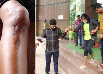 ಆರ್ಮಿ ಟ್ರೈನಿಂಗ್ ಮುಗಿಸಿ ಮನೆಗೆ ಹೊರಟಿದ್ದಾಗ ಅಪಘಾತ : ವೈದ್ಯರ ನಿರ್ಲಕ್ಷ್ಯದಿಂದ ಯುವತಿಯ ಸೇನೆ ಸೇರುವ ಕನಸು ನುಚ್ಚುನೂರು