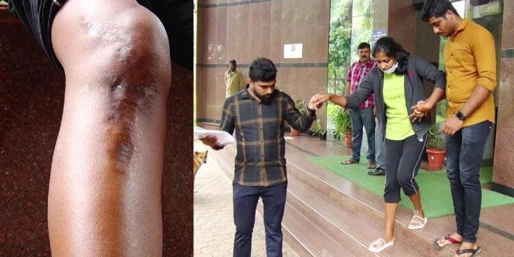 ಆರ್ಮಿ ಟ್ರೈನಿಂಗ್ ಮುಗಿಸಿ ಮನೆಗೆ ಹೊರಟಿದ್ದಾಗ ಅಪಘಾತ : ವೈದ್ಯರ ನಿರ್ಲಕ್ಷ್ಯದಿಂದ ಯುವತಿಯ ಸೇನೆ ಸೇರುವ ಕನಸು ನುಚ್ಚುನೂರು