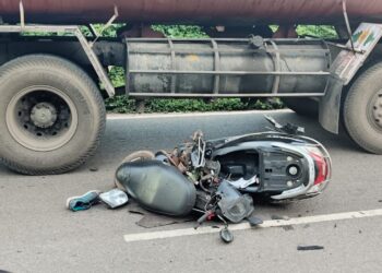 ಪರ್ಲಡ್ಕ : ಸ್ಕೂಟರ್-ಪಿಕಪ್ ವಾಹನದ ನಡುವೆ ಅಪಘಾತ : ದ್ವಿಚಕ್ರ ವಾಹನ ಸವಾರನಿಗೆ ಗಾಯ..!