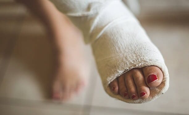 ಗಂಡನ ತೂಕದಿಂದ ಹೆಂಡತಿ ಕಾಲು ಮುರಿದು ಹೋಯ್ತು..!! ಪತಿಯ ವಿರುದ್ಧ ಠಾಣೆ ಮೆಟ್ಟಿಲೇರಿದ ಪತ್ನಿ