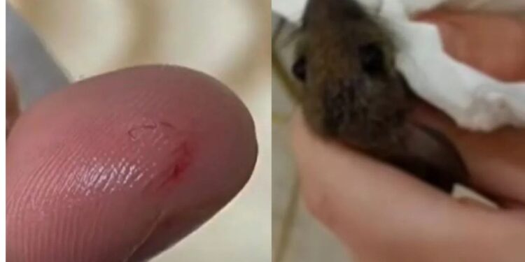 ಕಾಲು ಕಚ್ಚಿದ ಕೋಪಕ್ಕೆ ಹುಡುಕಿ ಇಲಿಯ ತಲೆ ಕಚ್ಚಿದ ಯುವತಿ : ಇಲಿ ಸ್ಥಳದಲ್ಲೇ ಸಾವು!