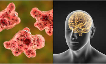 ಕೇರಳದಲ್ಲಿ ಕಾಡುತ್ತಿದೆ ಮೆದುಳು ತಿನ್ನುವ ಅಮೀಬಾ ಸೋಂಕು : ದ.ಕ ಜಿಲ್ಲೆಯಲ್ಲಿ ಹೈ ಅಲರ್ಟ್