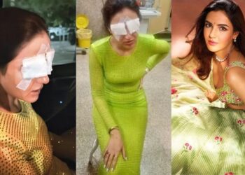 ಕಾಂಟ್ಯಾಕ್ಟ್​ ಲೆನ್ಸ್ ಎಡವಟ್ಟು : ನಟಿಯ ಕಣ್ಣಿಗೆ ಹಾನಿ!