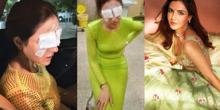 ಕಾಂಟ್ಯಾಕ್ಟ್​ ಲೆನ್ಸ್ ಎಡವಟ್ಟು : ನಟಿಯ ಕಣ್ಣಿಗೆ ಹಾನಿ!