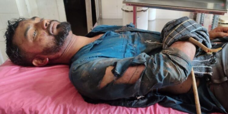 ಬೈಕ್ ನಲ್ಲಿ ಬರುತ್ತಿದ್ದ ವೇಳೆ ಕಾಡು ಹಂದಿ ದಾಳಿ : ಯುವಕನಿಗೆ ಗಾಯ!