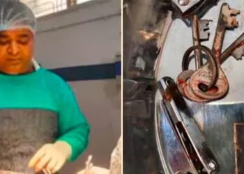 ಮೊಬೈಲ್​ ನೋಡುತ್ತಾ ಚಾಕು, ನೈಲ್ ಕಟ್ಟರ್, ಕೀ ಬಂಚ್ ನುಂಗಿದ ಬಾಲಕ ; ಆಮೇಲೇನಾಯ್ತು?