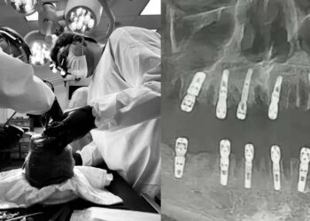 ಒಂದೇ ದಿನ 23 ಹಲ್ಲು ಕಿತ್ತ ವೈದ್ಯ ; ರೋಗಿ ಸಾವು