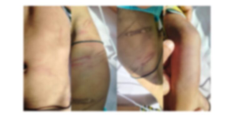 ಅಮಾನವೀಯ ಘಟನೆ : ಮಗುವಿನ ಮೇಲೆ ತೀವ್ರ ಹಲ್ಲೆ