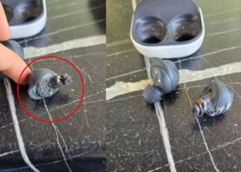 ಕಿವಿಯಲ್ಲಿದ್ದಾಗಲೇ ಇಯರ್​ ಬಡ್​​ ಸ್ಫೋಟ ; ಶ್ರವಣ ನಷ್ಟ ಅನುಭವಿಸುತ್ತಿರೋ ಯುವತಿ