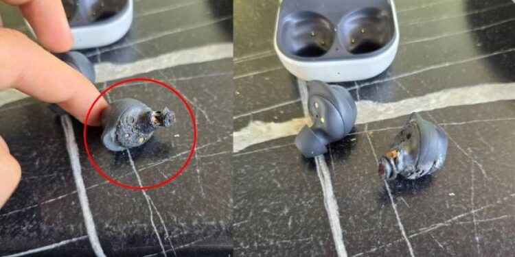 ಕಿವಿಯಲ್ಲಿದ್ದಾಗಲೇ ಇಯರ್ ಬಡ್ ಸ್ಫೋಟ ; ಶ್ರವಣ ನಷ್ಟ ಅನುಭವಿಸುತ್ತಿರೋ ಯುವತಿ