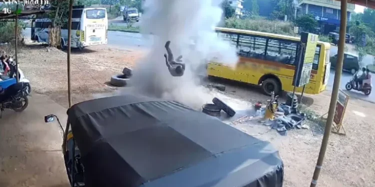 ಗಾಳಿ ತುಂಬಿಸುತ್ತಿದ್ದ ವೇಳೆ ಟೈರ್ ಸ್ಫೋಟ: ಯುವಕನಿಗೆ ಗಂಭೀರ ಗಾಯ