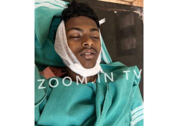 ಕ್ರಿಸ್ಮಸ್ ಹಬ್ಬಕ್ಕೆ ಮನೆಗೆ ಲೈಟಿಂಗ್ ಅಳವಡಿಸುತ್ತಿದ್ದಾಗ ವಿದ್ಯುತ್ ಪ್ರವಹಿಸಿ ವಿದ್ಯಾರ್ಥಿ ಮೃತ್ಯು..!!!