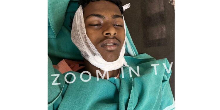 ಕ್ರಿಸ್ಮಸ್ ಹಬ್ಬಕ್ಕೆ ಮನೆಗೆ ಲೈಟಿಂಗ್ ಅಳವಡಿಸುತ್ತಿದ್ದಾಗ ವಿದ್ಯುತ್ ಪ್ರವಹಿಸಿ ವಿದ್ಯಾರ್ಥಿ ಮೃತ್ಯು..!!!