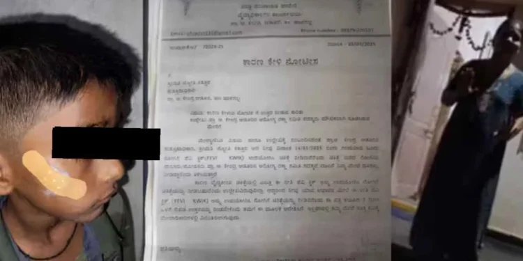 ಗಾಯಕ್ಕೆ ಹೊಲಿಗೆ ಹಾಕುವ ಬದಲು ಫೆವಿಕ್ವಿಕ್ ಹಾಕಿದ ಸರ್ಕಾರಿ ಆಸ್ಪತ್ರೆ ನರ್ಸ್..!!